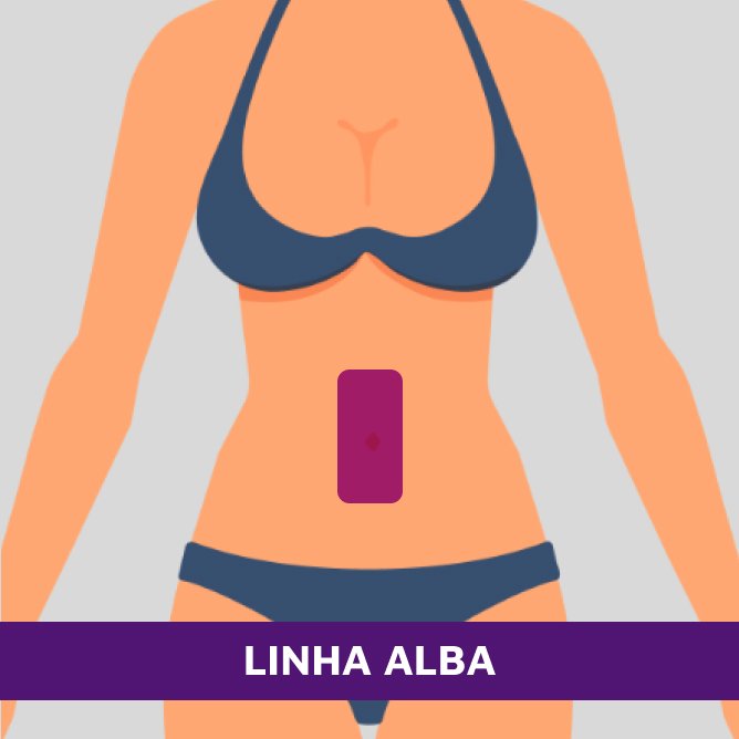 Linha Alba - 1